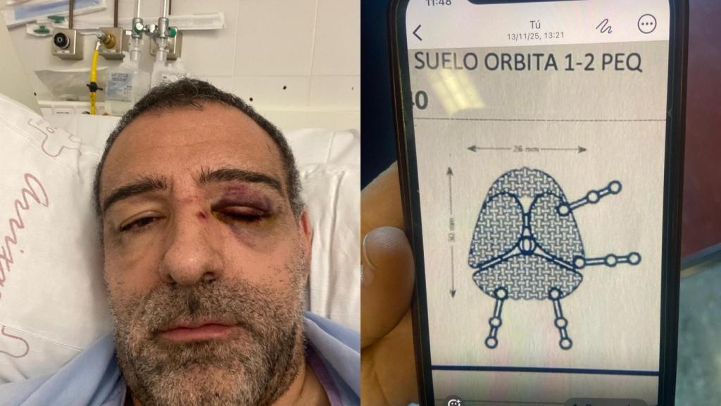 Gabriel, ingresado en La Arrixaca tras ser agredido por un repartidor el 22 de noviembre.