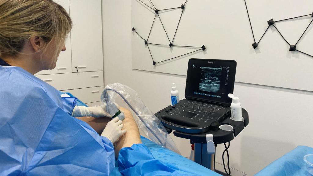 Sevilla avanza en el tratamiento de las varices sin cirugía con procedimientos ecoguiados.