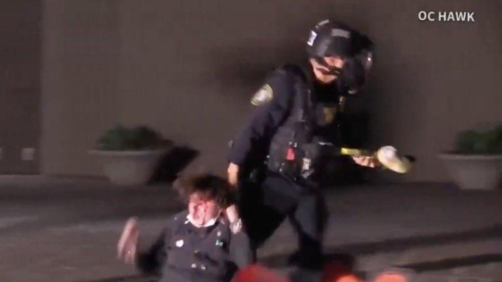 Momento en el que un agente policial agrede y arrastra al joven Kaden Rummler, que quedó ciego por un disparo.