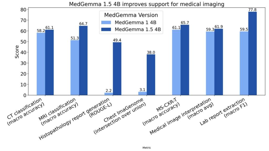Rendimiento de MedGemma 1.5 4B.