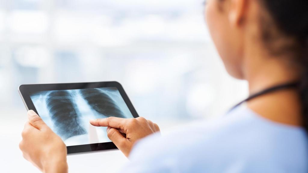 Para el desarrollo de PadChest  se han utilizado los datos de 4.555 radiografías de tórax revisadas manualmente por radiólogos