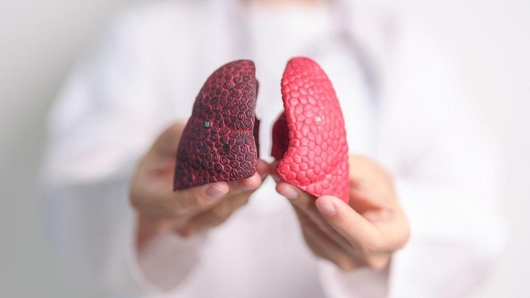 Recreación de un pulmón sano (derecha) y uno afectado por el tabaquismo (izquierda).