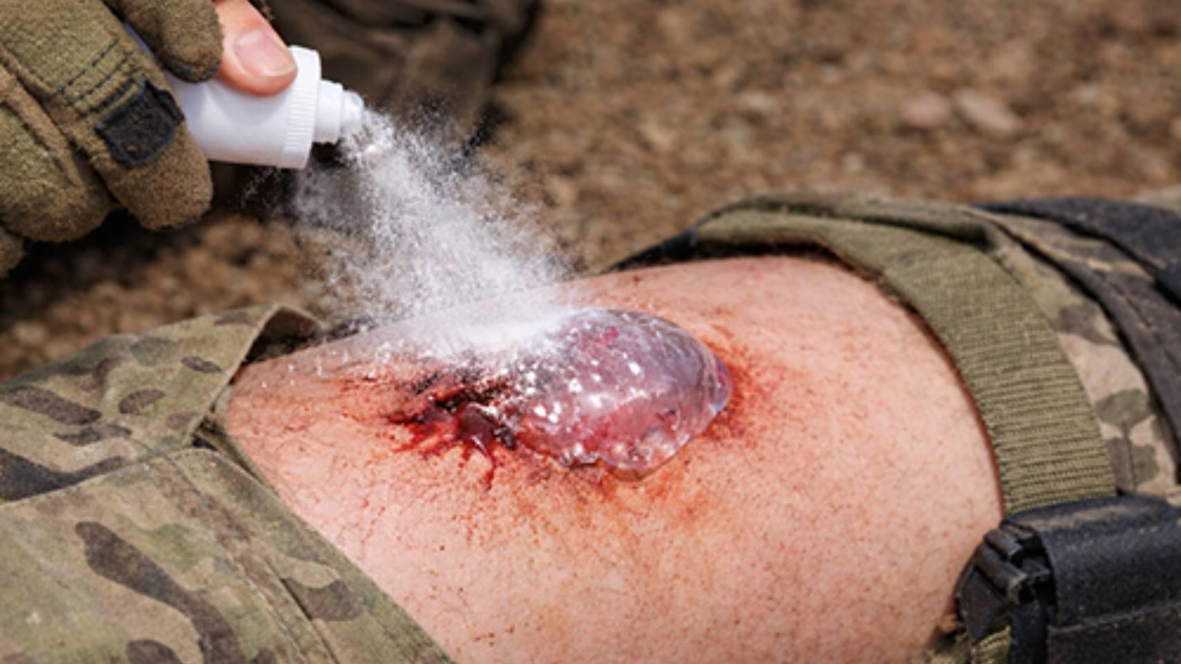 El spray que detiene el sangrado en tan solo un segundo de KAIST.
