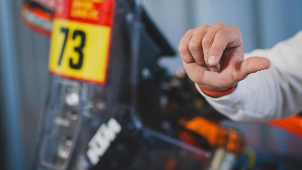 La mano dañada de Edgar Canet.