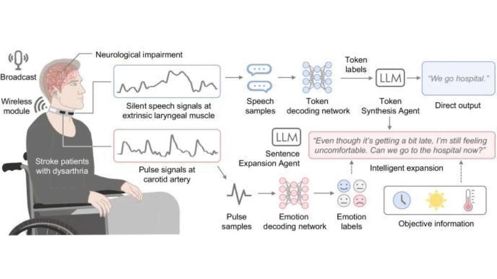 Esquema del funcionamiento de Revoice