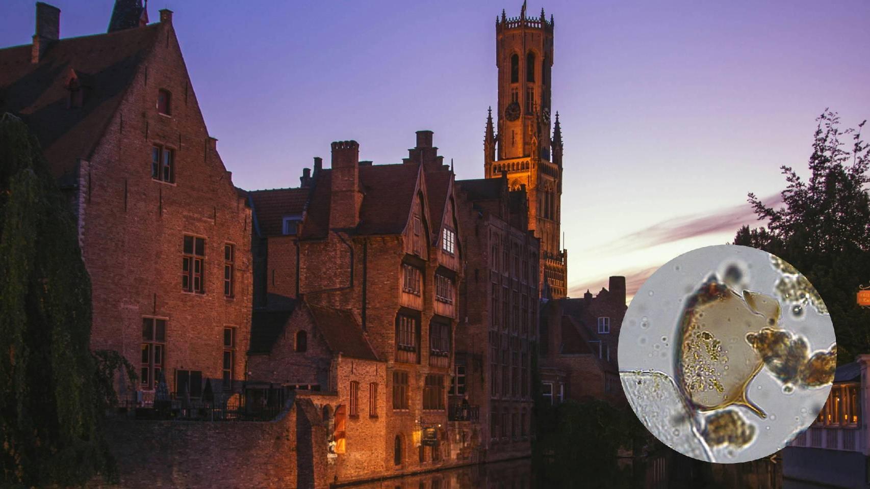 Los restos de 'Schistosoma mansoni' hallados en la letrina renacentista de Brujas. Marissa Ledger, McMaster University