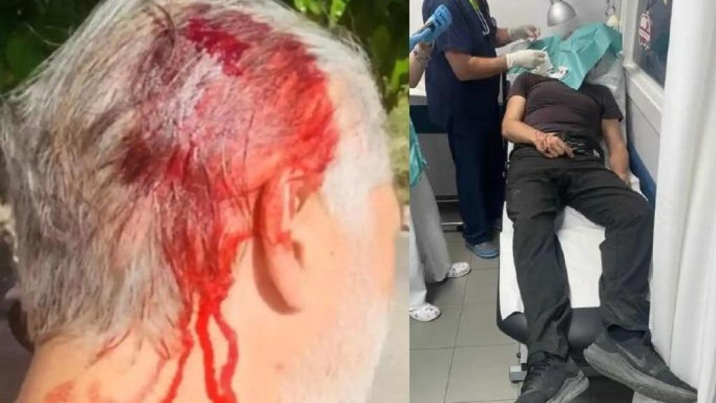 El subinspector de la Policía Nacional, en abril de 2023, atendido de urgencia tras recibir un hachazo en la cabeza cuando auxiliaba en Murcia a una joven que iba a sufrir un robo.