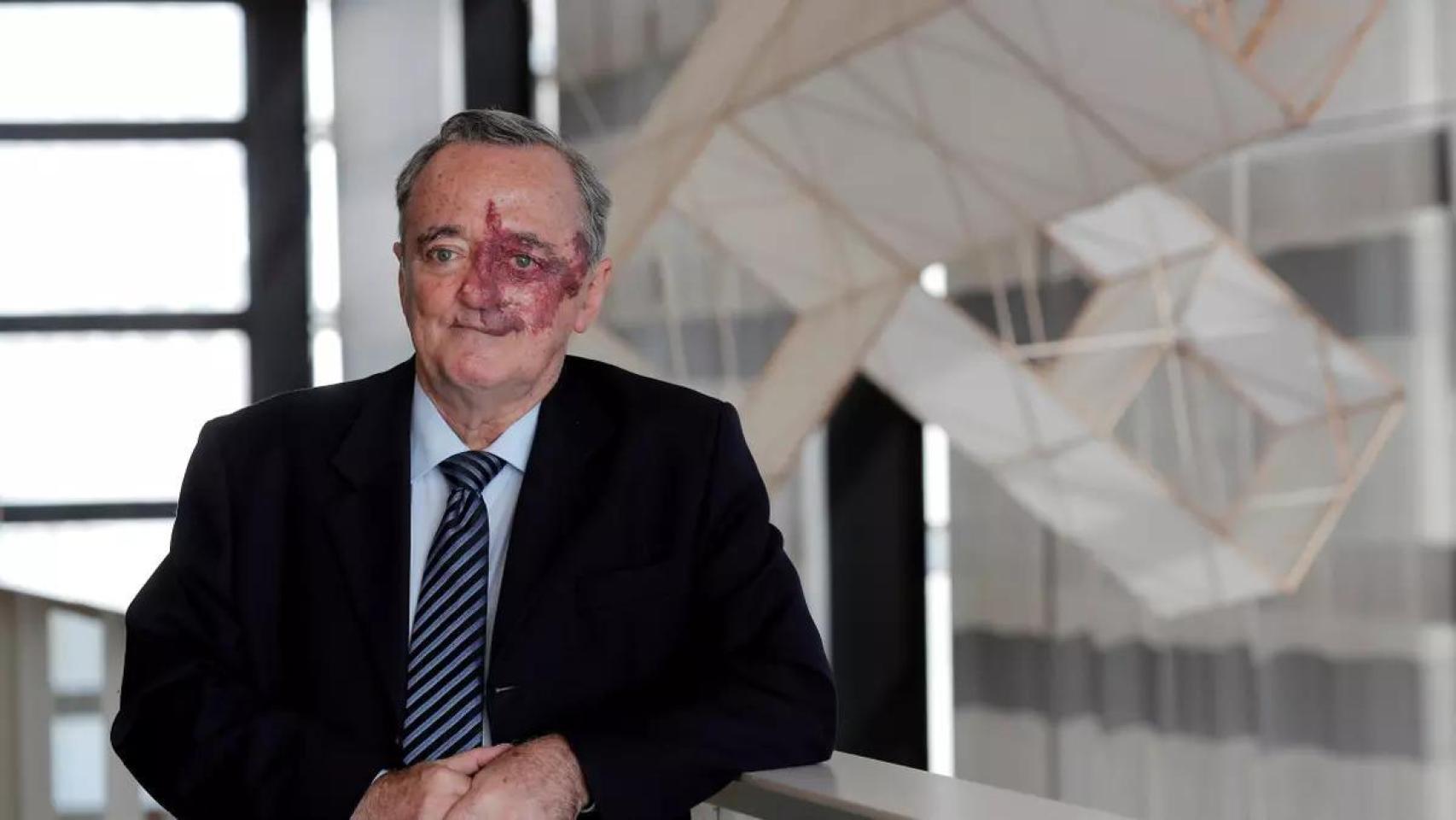 Mariano Barbacid, investigador clave del cáncer de páncreas: Hemos sido los primeros en lograr que desaparezca