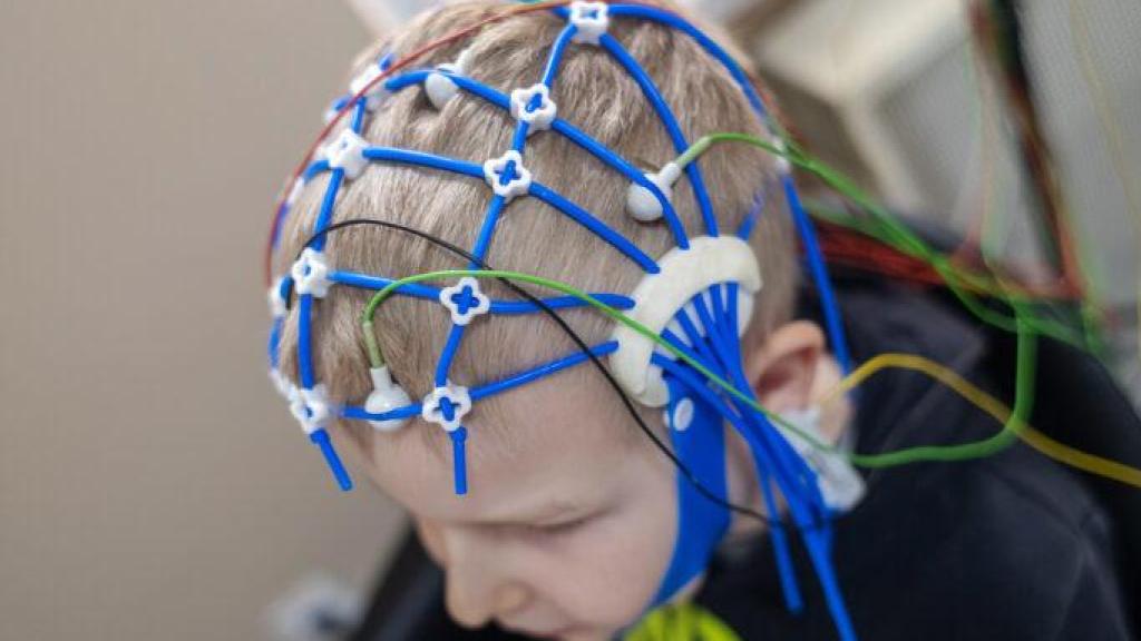 Un niño realiza un test neurológico. Dreamstime.