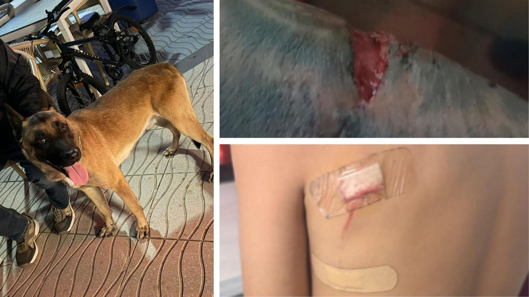 Detenido el dueño del perro que mordió a dos menores y dos adultos en Marbella