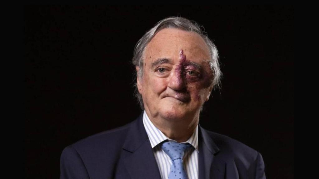 Mariano Barbacid es el jefe del Grupo de Oncología Experimental del CNIO.