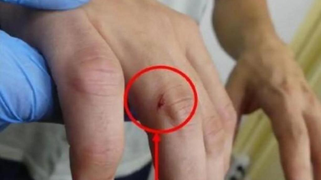 El puño ensangrentado de Felipe tras propinarle una paliza a su padre dentro de su tienda.