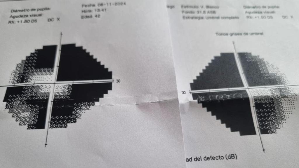 Así ven los ojos de David