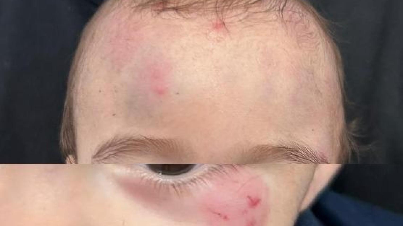 Una pareja de Sevilla denuncia «golpes» a su hijo de nueve meses ejercidos por la profesional de una guardería