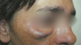 La madre de Ismael, con el ojo inflamado, tras ser golpeada por su pareja con el atizador, el pasado 31 de diciembre.