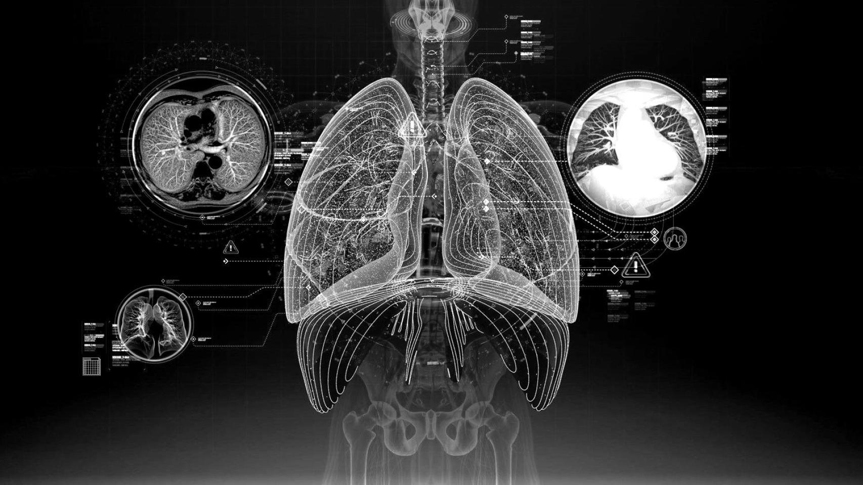 La inteligencia artificial y la sanidad