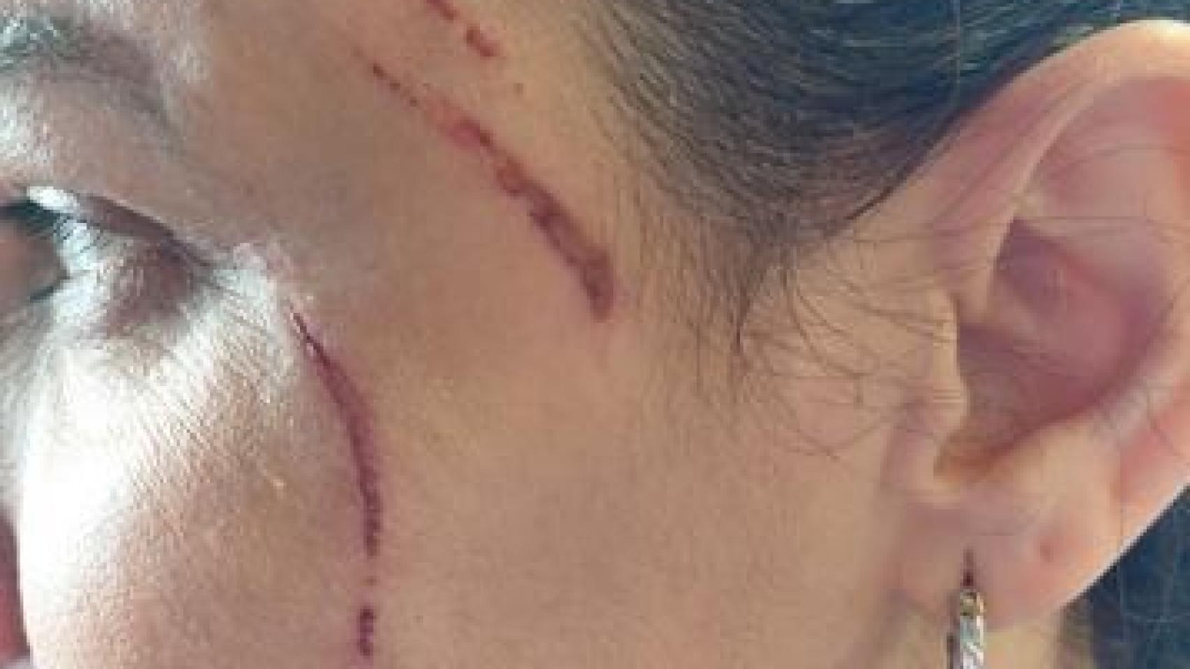 Imagen de Erica después de haber sufrido la agresión.