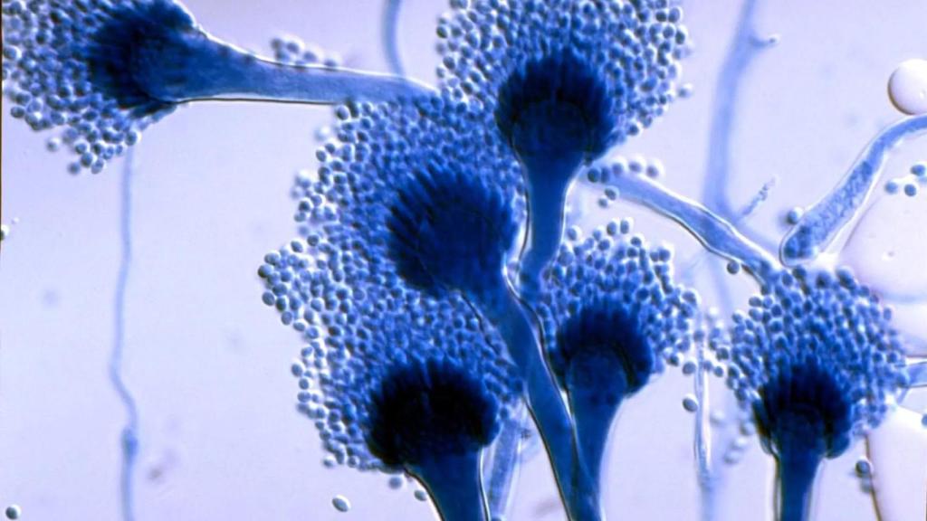 Aspergillus fumigatus visto de cerca.