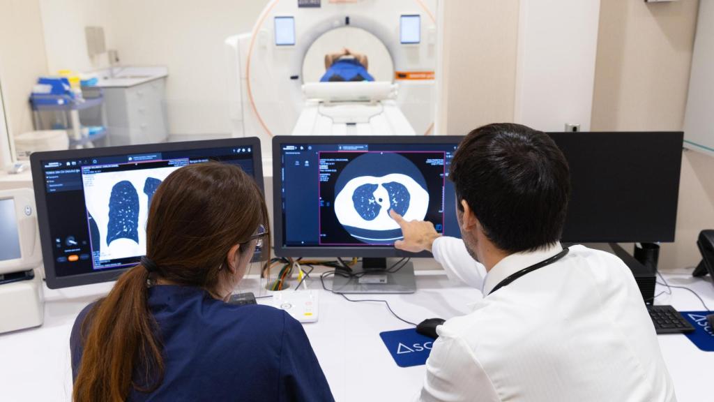 El Programa de Detección Precoz de Cáncer de Pulmón se dirige a fumadores y exfumadores mayores de 50 años. EE