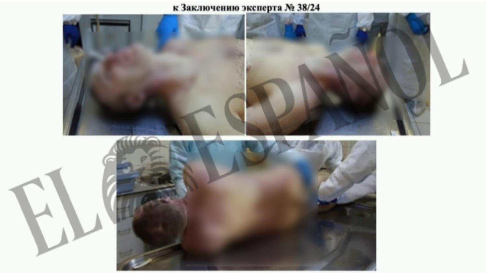Varias imágenes del cuerpo sin vida de Alexey Navalny incluidas en los anexos de la autopsia.