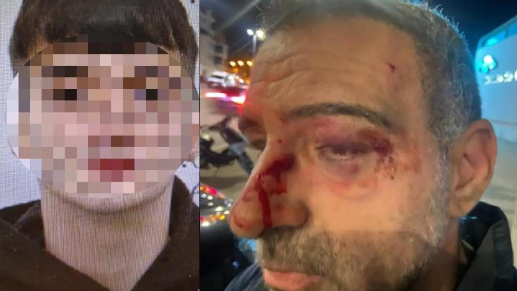 Iván, el rider que supuestamente agredió a un policía nacional fuera de servicio, junto al agente Gabriel tras ser golpeado con un casco.