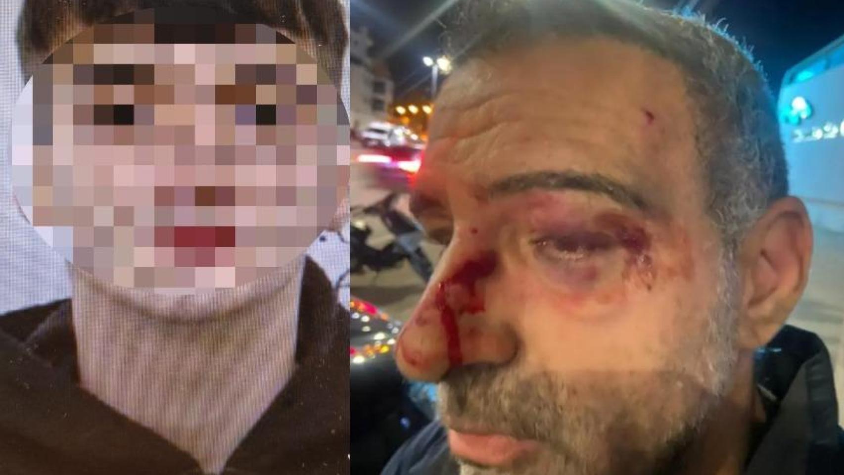 Iván, el rider que supuestamente agredió a un policía nacional fuera de servicio, junto al agente Gabriel tras ser golpeado con un casco.