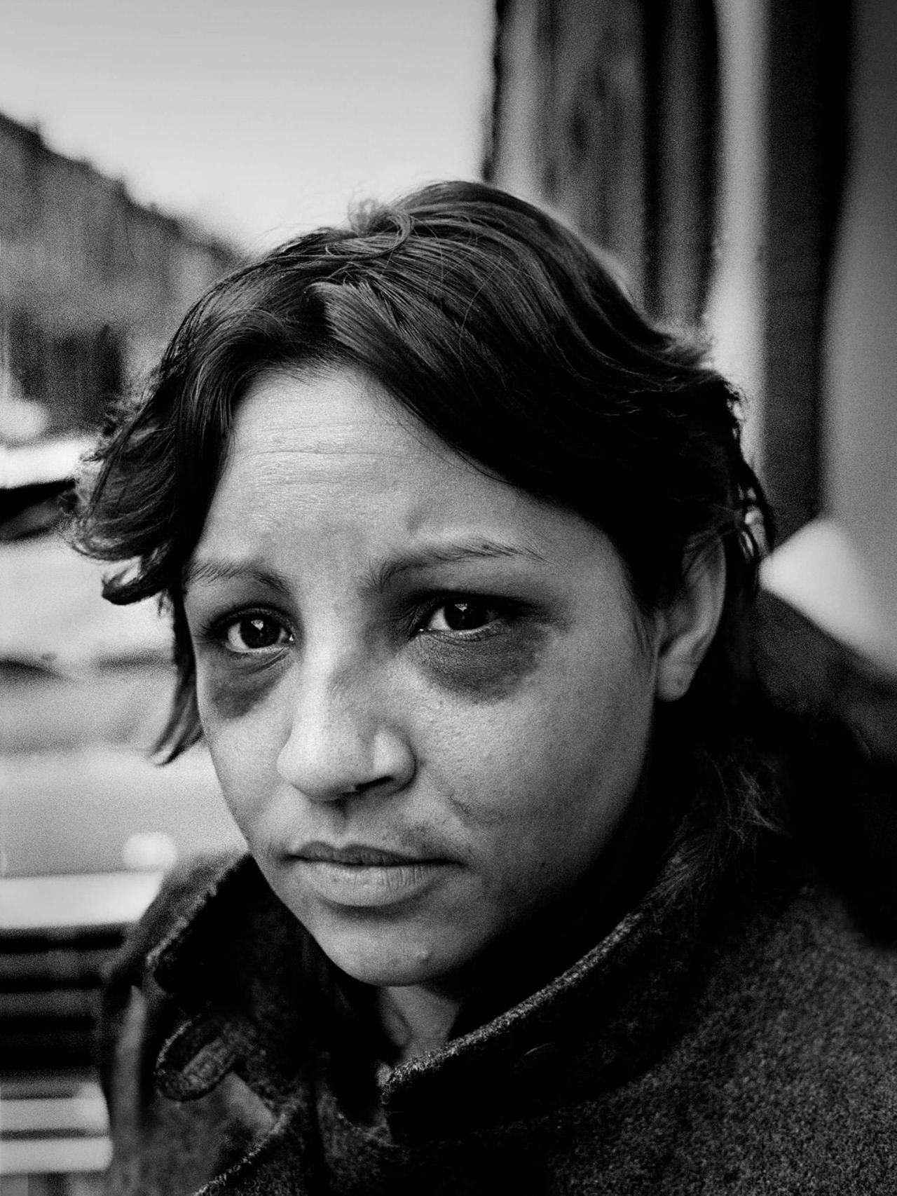 Rita. Philadelphia, Pennsylvania. 1986. Rita's story was turned into the first battered woman to appear in a national magazine.