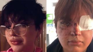 Dos imágenes de Bianca Lizbeth Fernández, una de ellas tras la agresión