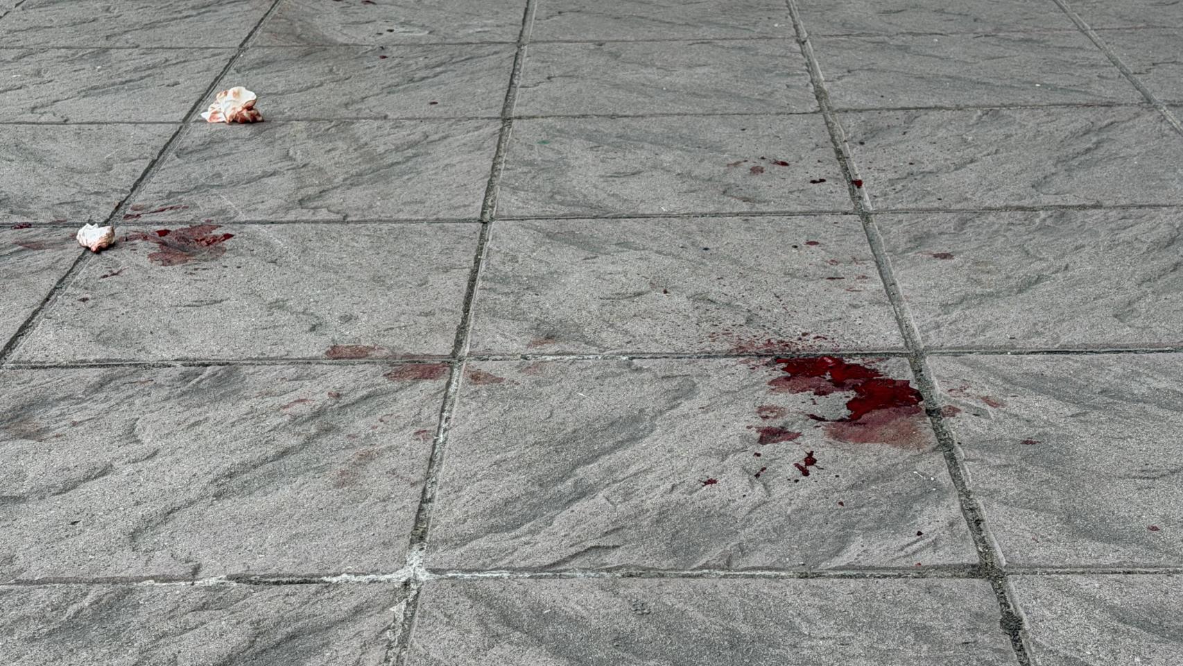Imagen de la sangre.