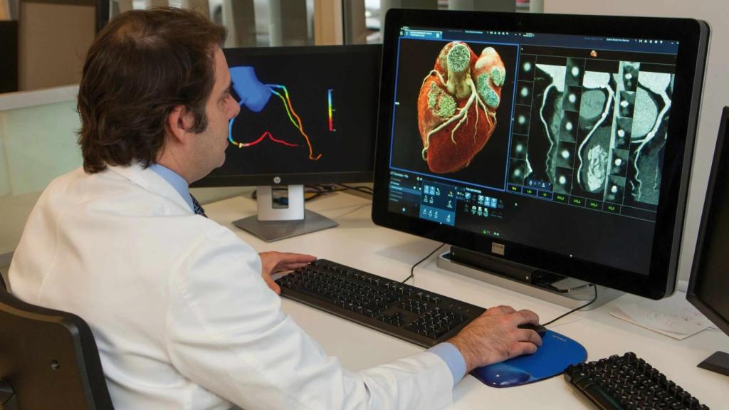 Imagen de archivo de una realización de coronariografía por TAC para la valoración de arterias coronarias.