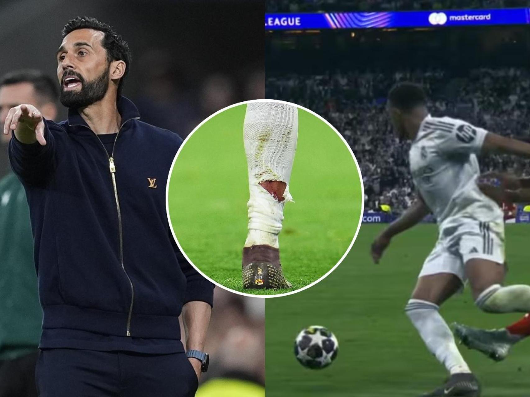 La expulsión perdonada a Tah que enfadó a Arbeloa