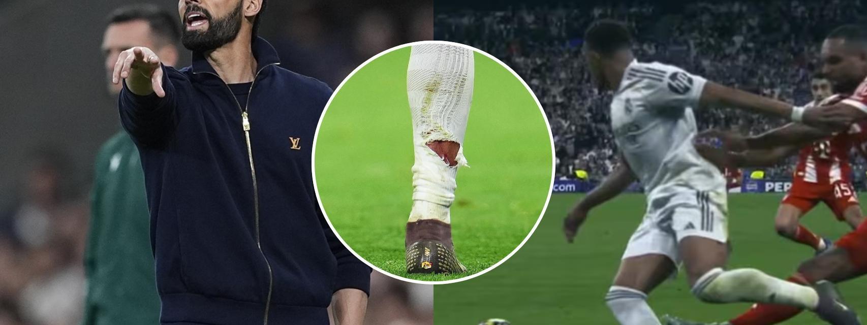 La expulsión perdonada a Tah que enfadó a Arbeloa