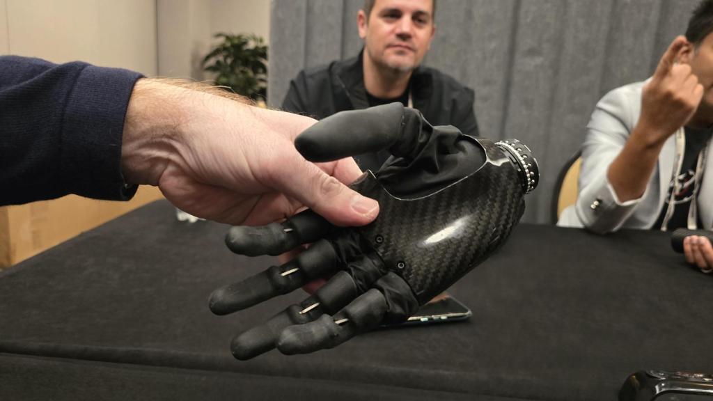 La mano biónica de Psyonic.