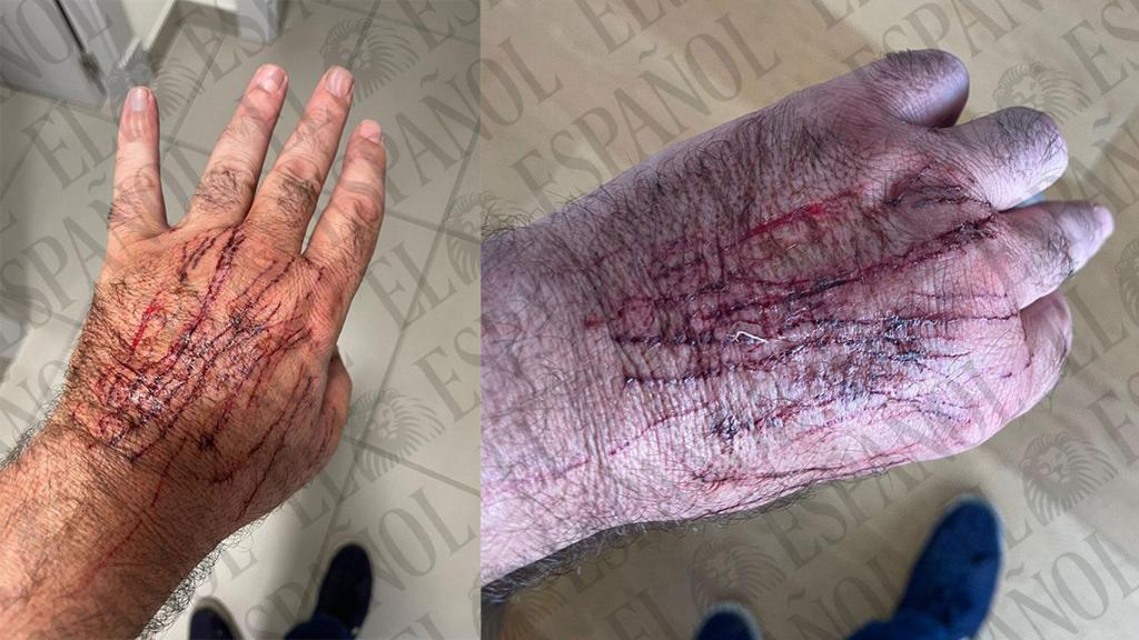 Las heridas de Koldo García provocadas por la gata de José Luis Ábalos.
