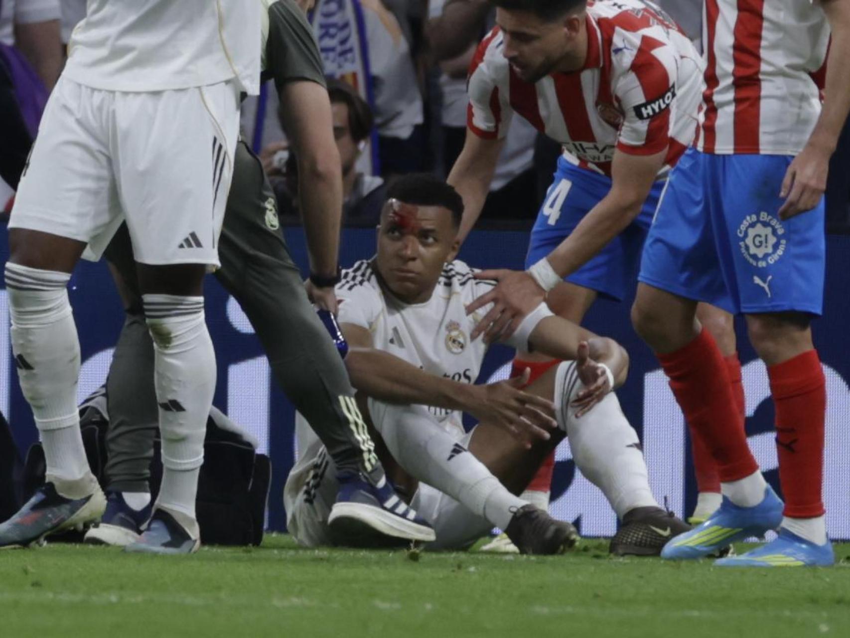 Mbappé, con sangre en la cara durante el partido ante el Girona.