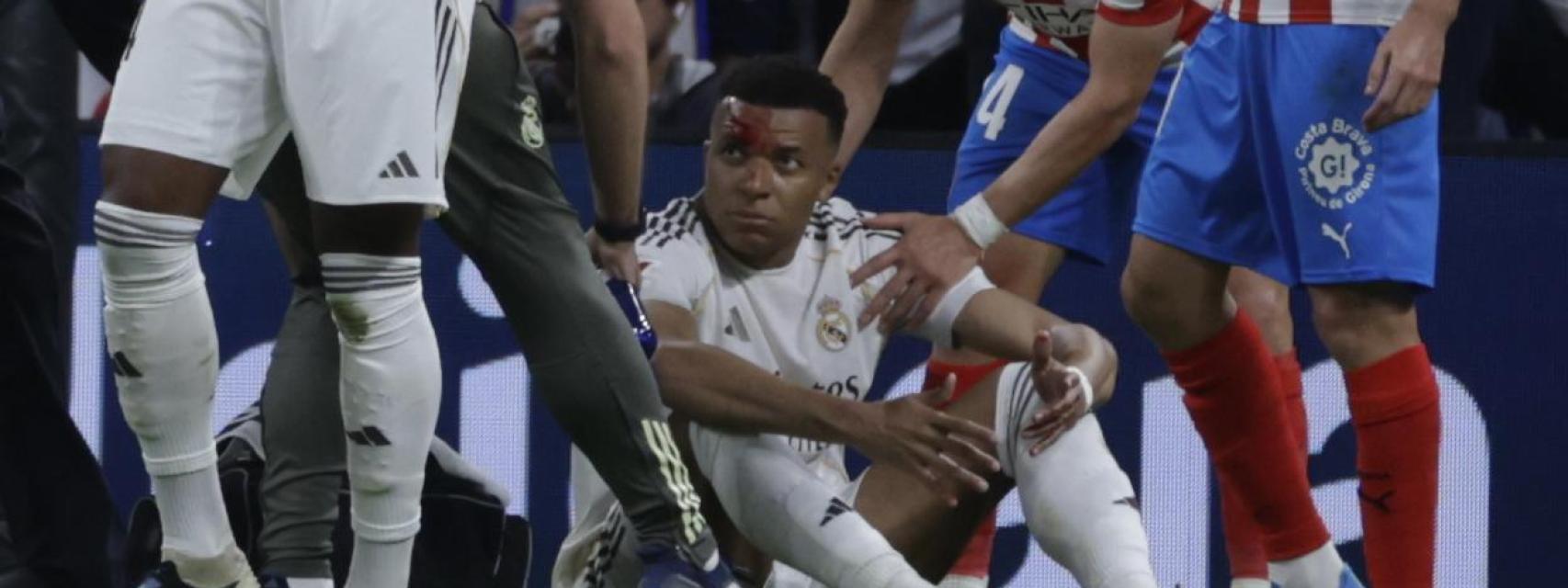 Mbappé, con sangre en la cara durante el partido ante el Girona.