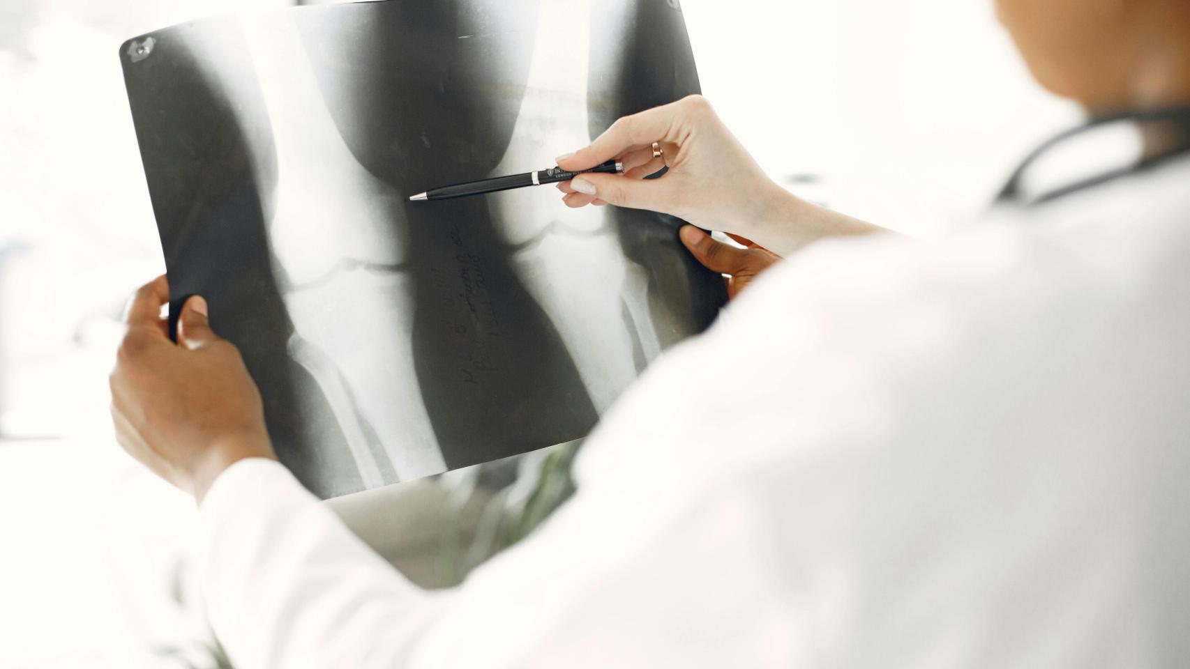 Imagen de un doctor examinando una radiografía.