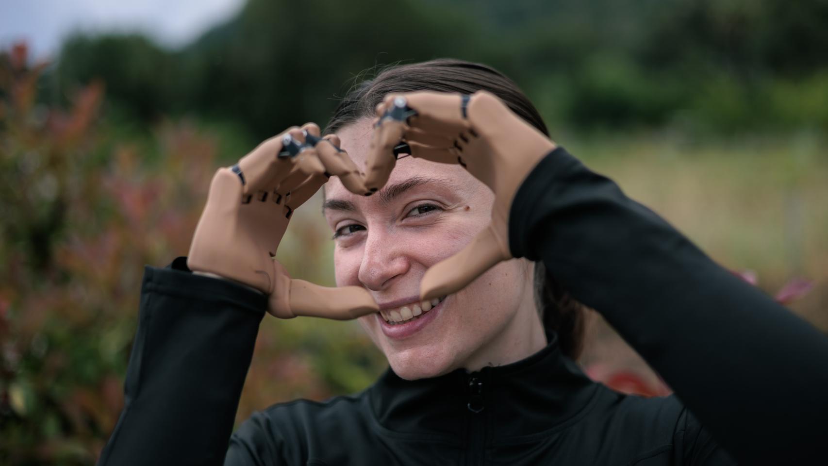 Carla Maronda, la joven de Xàtiva que sufrió una cuádruple amputación