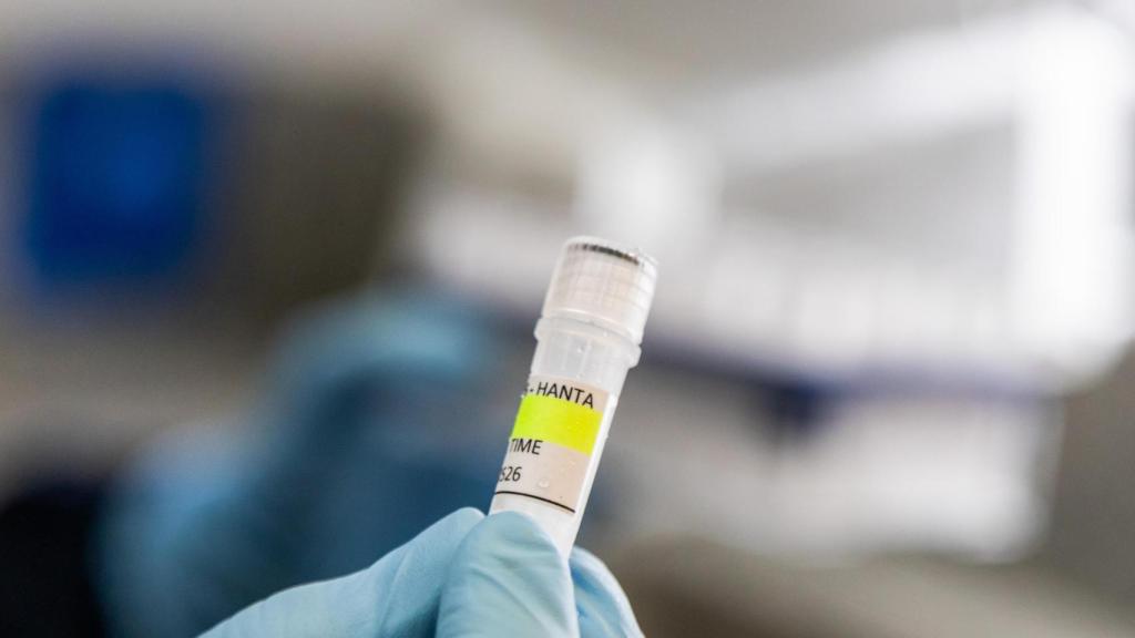 Los insumos que enviará Malbrán, el organismo público científico-tecnológico de Argentina dedicado a la salud, enfocado en el diagnóstico, investigación, vigilancia epidemiológica y producción de biológicos para enfermedades infecciosas.