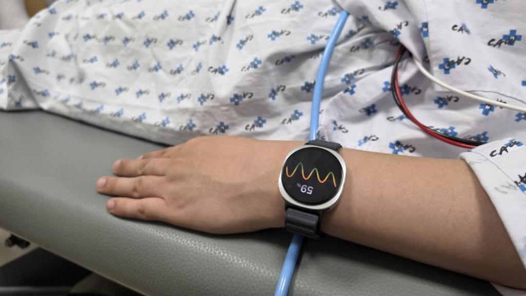 Un paciente con un reloj inteligente Samsung Galaxy Watch