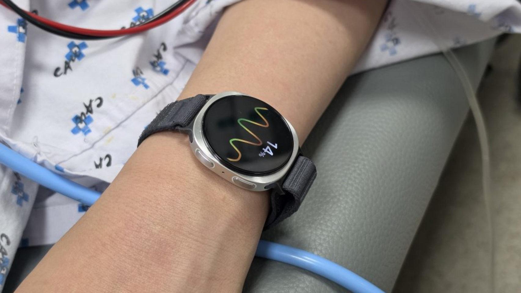 Un paciente con un reloj inteligente Samsung Galaxy Watch