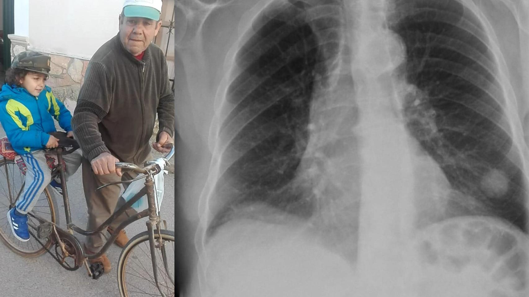 Julio, montando a su nieto en su vieja bicicleta. Al lado, la radiografía que le hicieron en enero de 2024 y donde aparecía un tumor que le costó la vida.