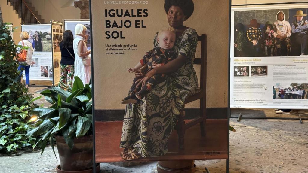 Llega a Vigo una exposición fotográfica sobre la realidad del albinismo en África subsahariana
