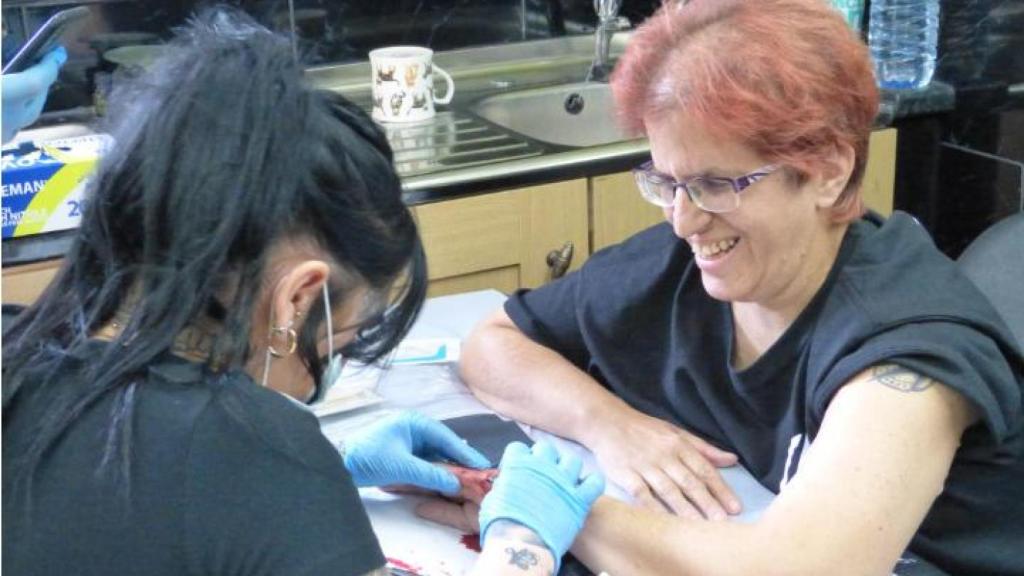 Colocan a Sandra Würthner uno de los chips que lleva en la mano izquierda.