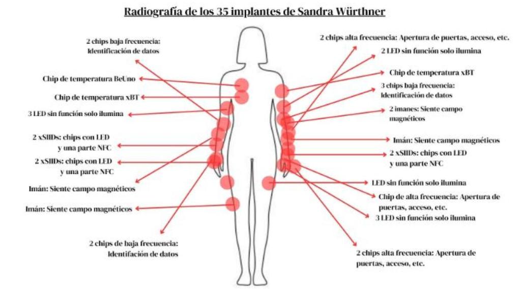 La localización de todos los chips  que tiene Sandra Wurtner en su cuerpo.