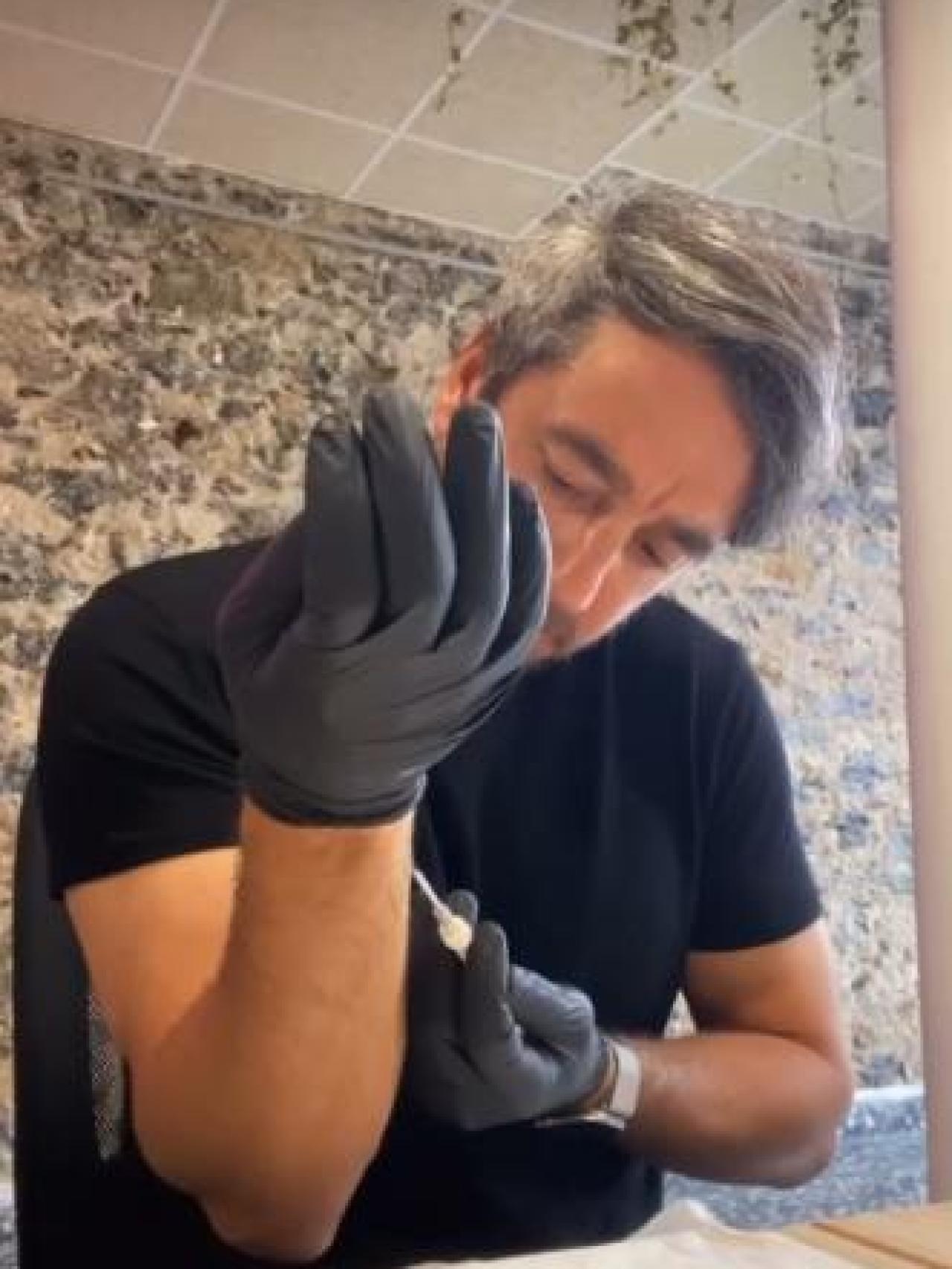 Elbio Nielsen implantándose un chip en la muñeca del brazo derecho.