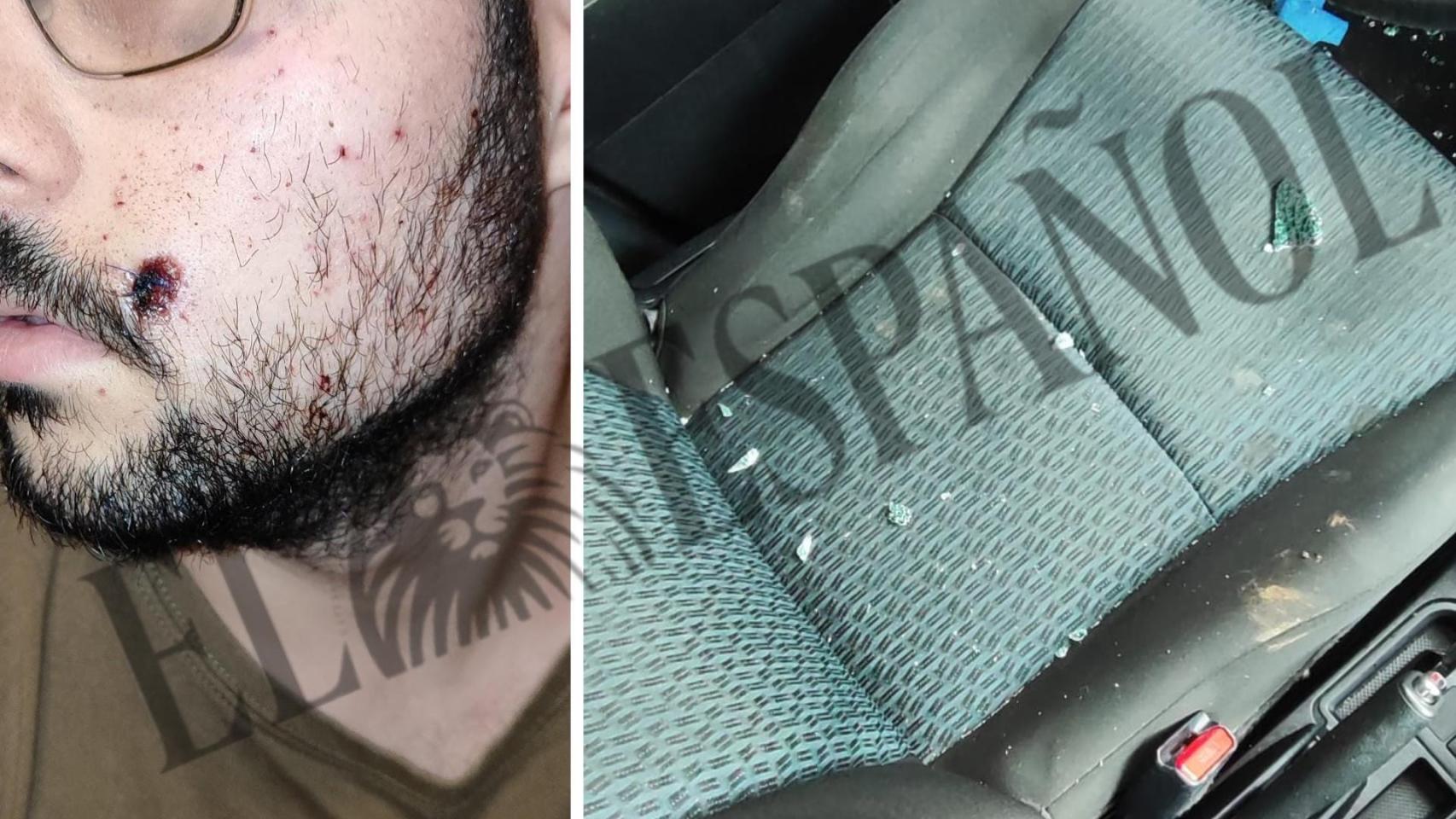 Una imagen de la herida del balazo y los restos de vidrio en su coche.