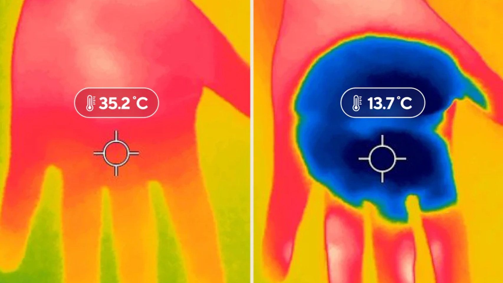 Efecto del CryoTherm Palm en las manos