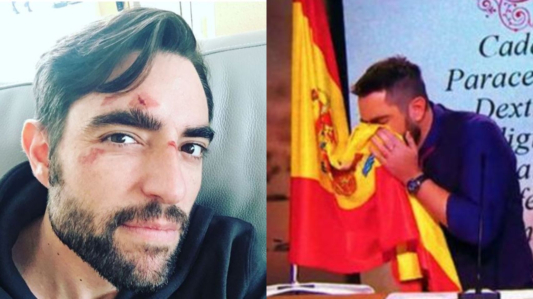 A la izquierda, Dani Mateo luciendo heridas tras una caída. A la derecha, en el momento polémico de su sketch.