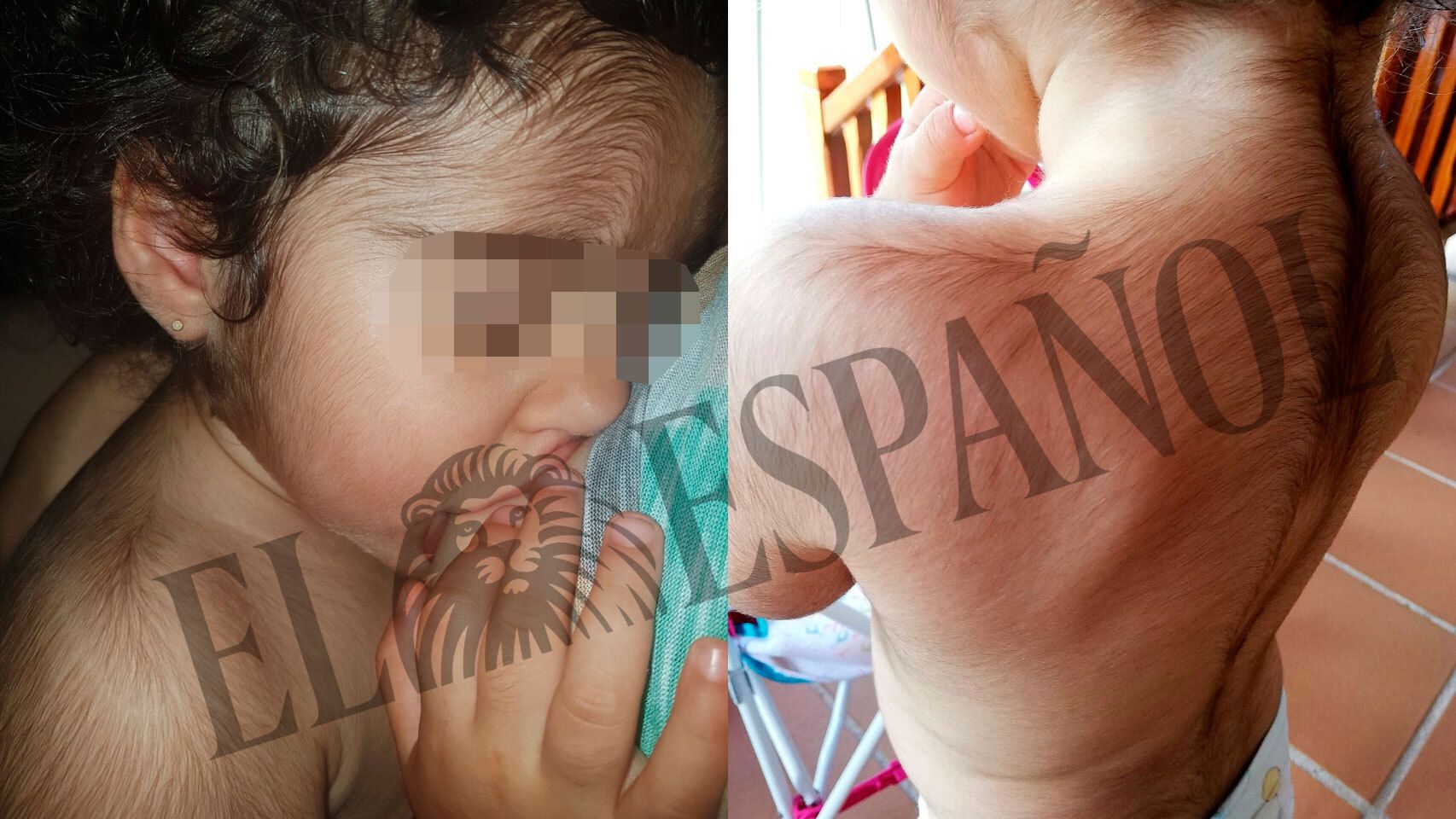 La pequeña Maite tiene todo el cuerpo cubierto por abundante vello.